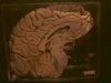 cerebro3