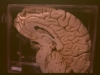 cerebro6